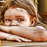 photo of a little girl sitting at a table with scrapes and dirty wounds in need of a parasite cleanse